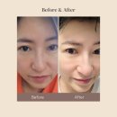 새로연 | 피부좋아지는법 세안비누 추천, 비타민팩까지 가능한 새로연 비타클렌징 솝 리얼후기