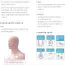 새삼성약국 | 남편의 뇌심부자극술(DBS) 후기/ 삼성서울병원