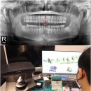채움치과기공소 이미지
