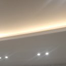 리더스서울안과의원 | 화곡동 서울리더스안과 아이 드림렌즈 후기 검사부터 착용까지