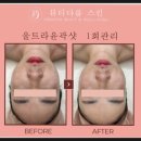 뷰티다룸(BEAUTY DARUM) 잠실갤러리아팰리스점 | 잠실 피부관리, 뷰티다룸 여배우관리 비결은 바로 이것!