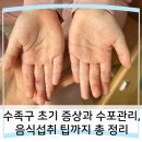 수족구 초기 증상과 수포관리, 완치시기 | 음식섭취 팁까지 총정리