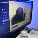 동성부분정비 | 대구 탈모 예방 웰킨두피탈모센터 대구동성점 두피스케일링 후기