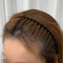 솔비헤어라인