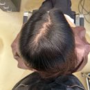 라비살롱 - 의정부시 평화로 274 | 가르마비침 고민 해결 정수리볼륨 링거펌 라비살롱 서울대입구역점 후기