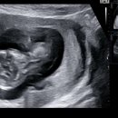 목포미즈아이병원 이미지