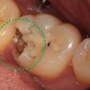 메디포레치과의원 이미지
