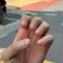 베디네일