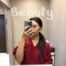 팔자주름 쥬브젠 후기 잠실 피부과에서 받은 솔직 경험