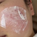 완산-134 | 전주 효자동 피부관리 추천 │ [슬림앤뷰티] 여드름관리로 매끈한 피부 완성