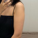 청담동 피부과 청담 팔뚝 온다리프팅 받고 온 후기