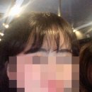 청담유성형외과의원 네이버블로그