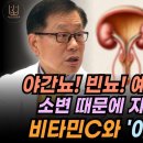 [편집전 미방영분] 이왕재박사. 나이들수록 소변이 자주 마려운 이유. 야간뇨 줄이는 가장 싸고 쉬운 방법 이미지