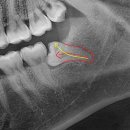 호평나무치과의원 이미지