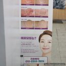 뷰티지현 | 고잔동 피부관리 지현뷰티, 마이크로젯 관리 솔직후기