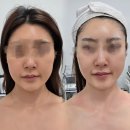 더(The)특별한날 | 광주 첨단피부관리 미백리프팅추천 보톡스앰플 솔직후기 The 특별한 날