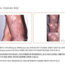 길흉부외과 네이버블로그