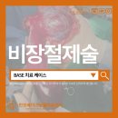 배박사 동물병원 | 의심됐던 11cm 비장종괴 │ 비장절제술 케이스 ㅣ 잠원동물병원 서초동물병원 반포베이스동물의료센터