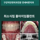덕계더바른의원 | 양산덕계치과 임플란트, 전체 치아를 단 4개로? '최소 식립 풀아치'의 기적