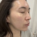 손길닿음 | 초량피부관리 신부관리 추천 손길닿음 물방울리프팅 후기