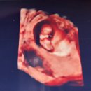 봄산부인과의원 | [임신일기.7] 임신7주-11주 입덧시작 / 9주차 젤리곰 &amp; 원주 연세봄산부인과 / 임밍아웃 카드추천