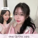 [퇴근길] 직장인통증관리 | 대구동구피부과 텐써마 고현정 리프팅 300샷 통증 붓기 주의사항