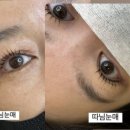 블링수