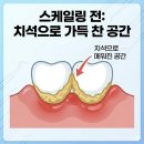괴정아트치과의원 네이버블로그