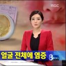 MGF두피탈모센타