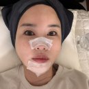 300 | 해운대 피부과 효과 빠른 고현정 리프팅 텐써마 300샷 후기!