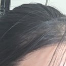 듀오헤어 | 올영트리트먼트 헤어케어세트 추천 원오세븐 스칼프 헤어 스파 듀오 리얼후기