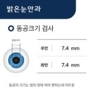 연세준안과의원 이미지