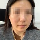 닥터디엣 글루타치온 내돈내산 후기