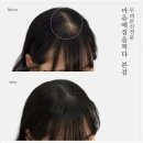 마음에 점을 찍다 | 두피문신 남성 탈모 고민으로 시작한 변화, 마음에 점을 찍다 광주본점 SMP 두피문신 탈모 솔직 방문 후기