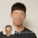 천호 남자 맞춤가발 추천, 박승철위그스투디오 천호점 리얼 후기 (송파,잠실 탈모 해결)