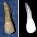 정 치과보존과 치과의원 이미지