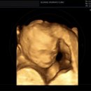 세상의반여성의원 이미지