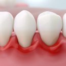 탑티어치과의원 이미지