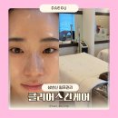 클리어스킨 | 대구웨딩피부관리 추천 클리어스킨케어 상반신 전체 림프관리 솔직후기