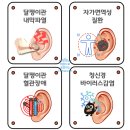 골든AD | 청주보청기] 돌발성 난청과 이명으로 고통중이던, 모충동 어머님의 '포낙 인피니오 스피어' 감동 착용 후기