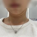 [수원 광교] 이중턱 브이올렛 2cc 후기
