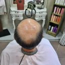 대구 수성구 지산동 헤어샵 남성탈모 가발 자연스럽게 해결한 후기 :: 살롱드메이페어