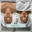 더안 | 진주 예신관리 피부관리 추천 에어인, 윤곽관리 후기 더안뷰티