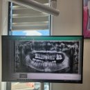 조은에스치과의원 | 대구 조은에스치과의원 치조골이식,뼈이식