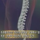 [척추관협착증] 자생한방병원에서 알려드리는 척추관협착증에 효과적인 온열찜질요법 이미지