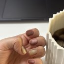 오감네일 | 경기광주 문제성발톱 케어 잘하는 곳｜오감네일 오로지푸스 자석네일 후기