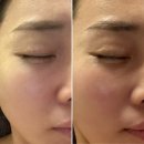 울산 삼산동 피부관리 드끌레오에스테틱 물광관리 효과 최고