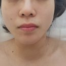 구파발 피부관리 페이스 리프팅이 필요하다면 :: 에스제이랩