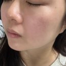 극광 | CELLABEAUTYLAB 극광앰플 후기｜물광피부 만드는 셀라 메조 익스트림 앰플 후기 탄력앰플 추천