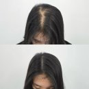 우성동물병원 | 동탄SMP뜻 다이어트탈모극복 도트락동탄점 솔직 후기